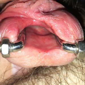 Open wide! No WIDER!