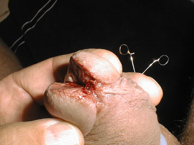 Finish up with knife