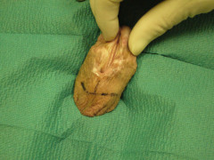 Going to the next step