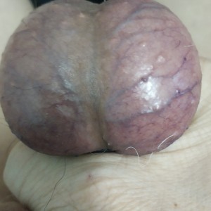 My  balls