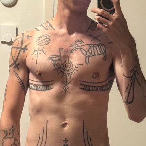 after 70/70cc silicone per pec
