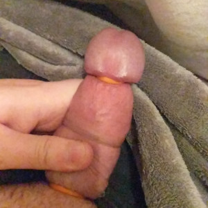 A fun part of being uncut is the option to just hide the band behind your glans!