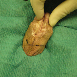 Going to the next step