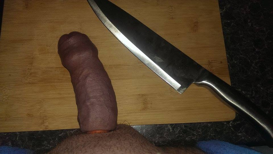Would you cut just the band off, or...?