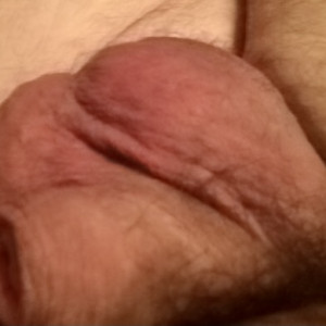 Before Injections 
