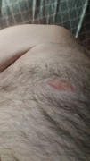 No nipple