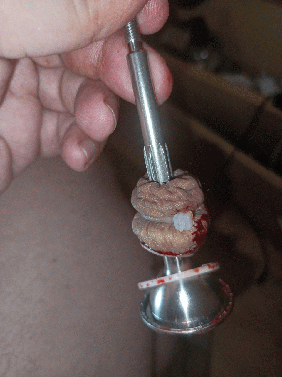My forskin after being cut off pic 7