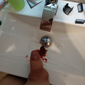 Yes, its blood