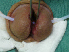 save the ampallang while splitting