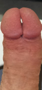 split glans bisection