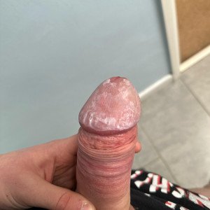 Verruca cream