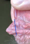Depiction of how I think I’d like to trim the extra flap from the frenun, likely with tie method too. 
