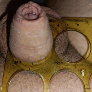 Pic 2