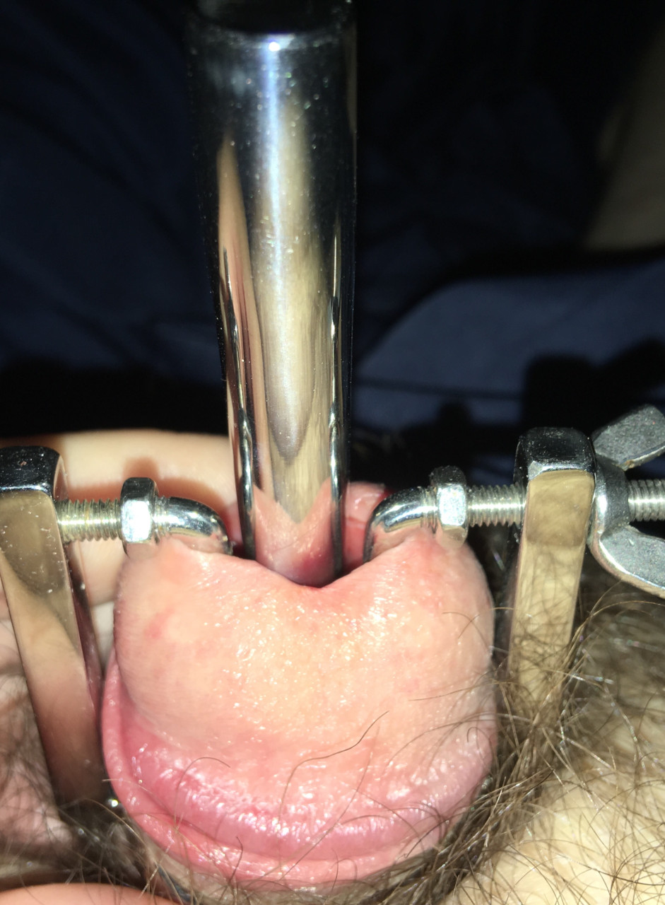 Before meato, using tapered sound with stretcher 