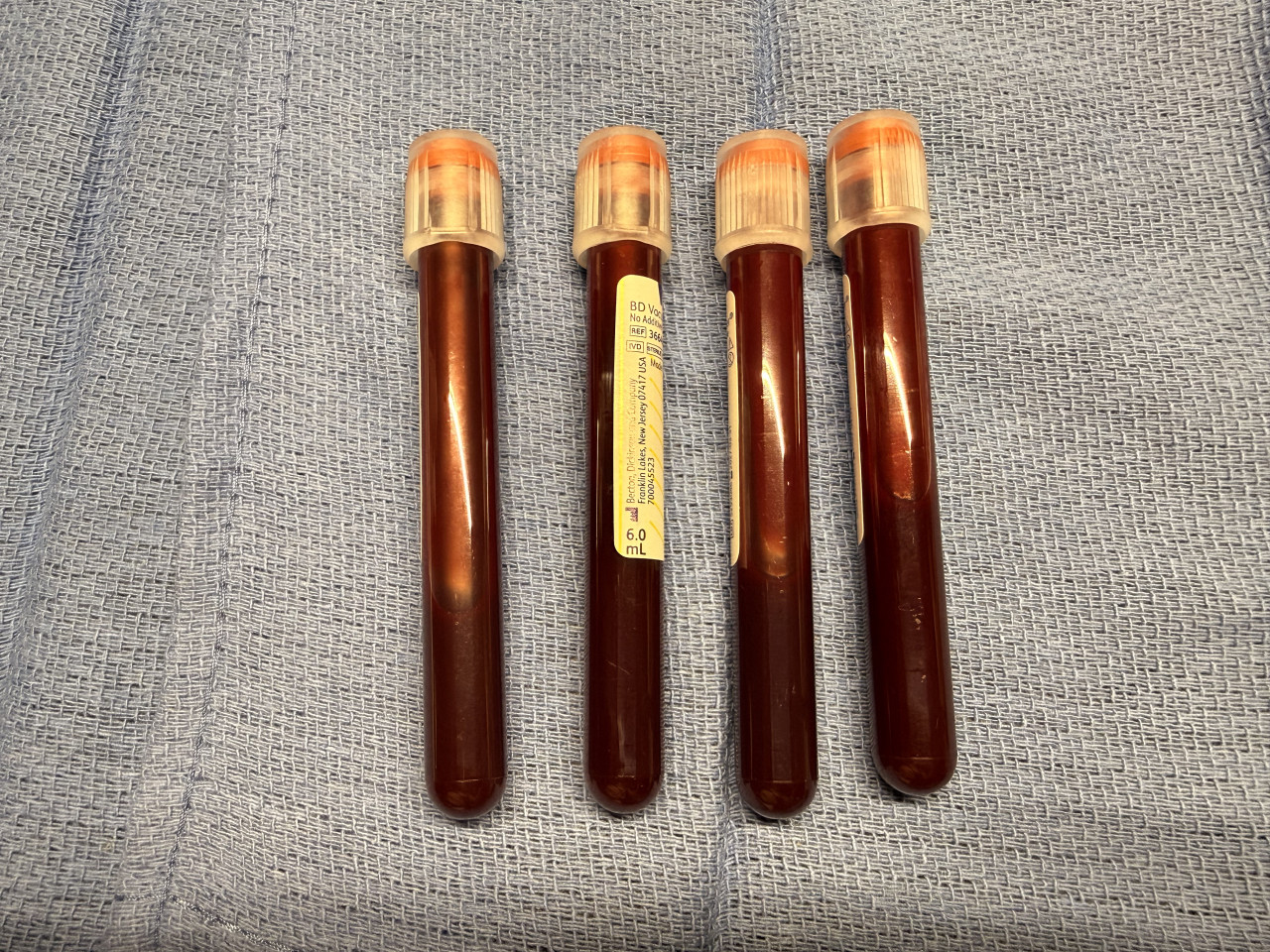 Samples Obtained From Penis