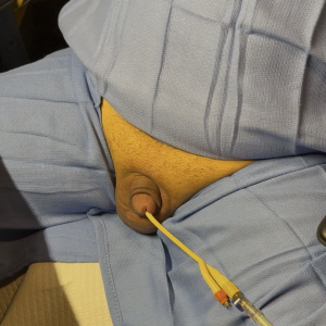 Cock Retracting Into Body From Pain/Punishment