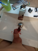 Yes, its blood