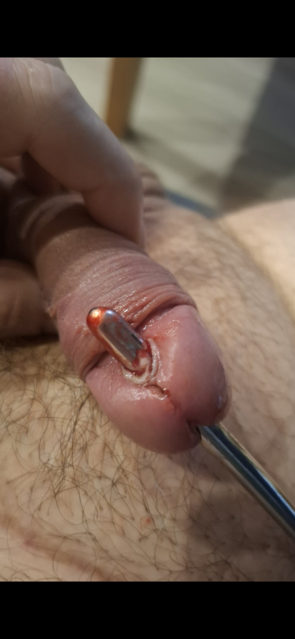 Wann reißt die Eichel wohl