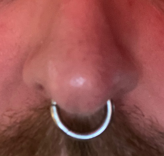 Septum @3,0mm