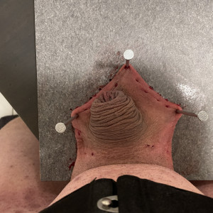 Needle-free scrotum