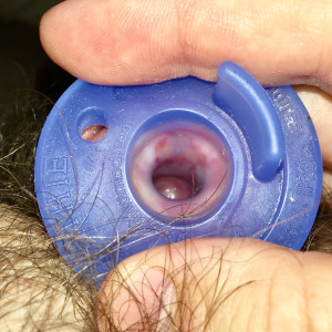 Trying a pacifier to see into my stretched meatus