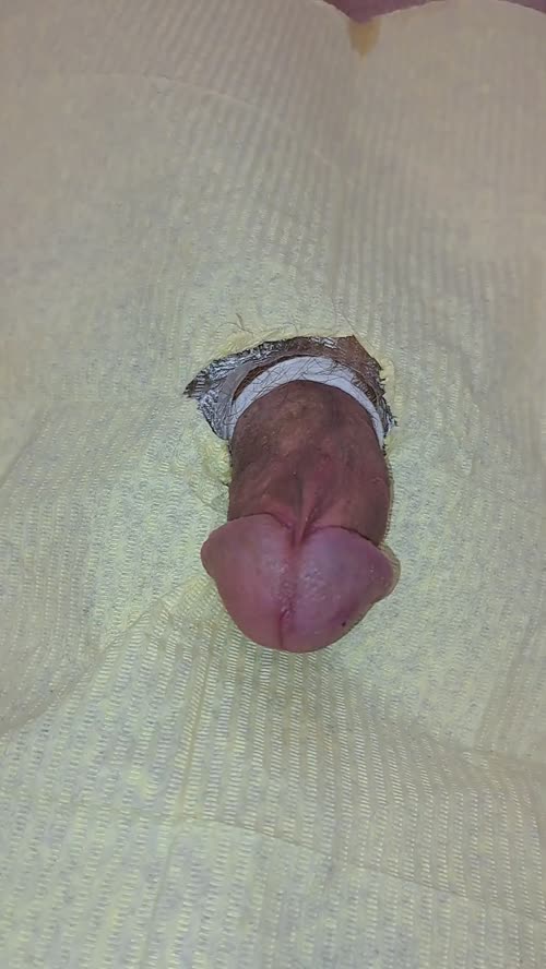 16G needle in my cockhead 