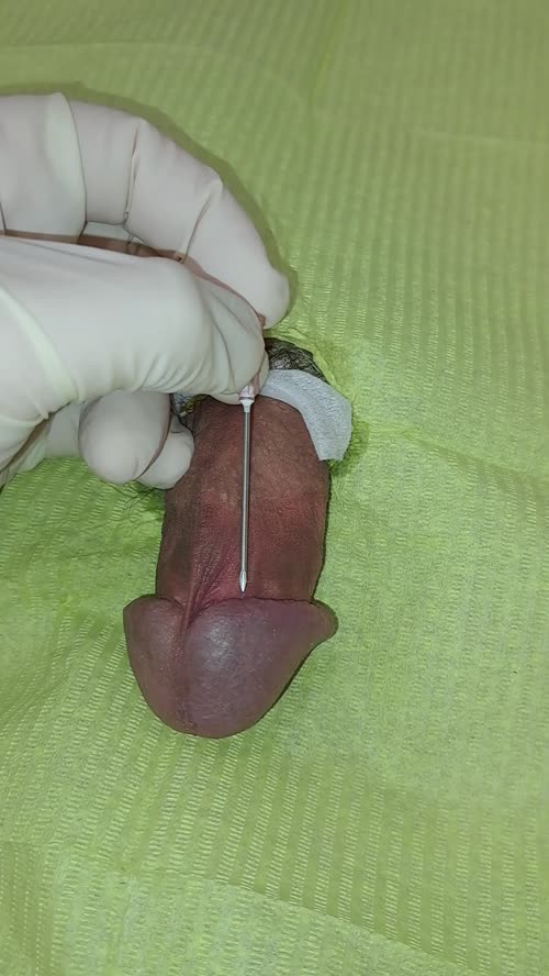 18G needle through my cockhead 