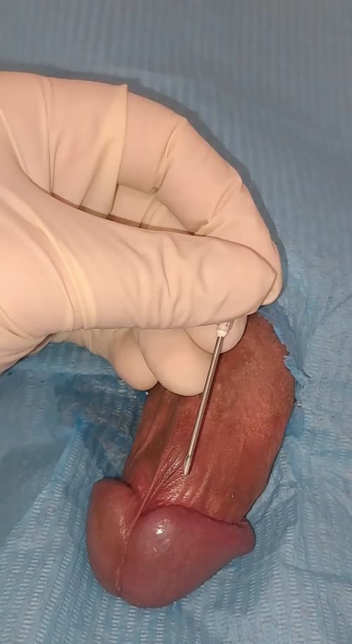16G needle deep into my penis head 